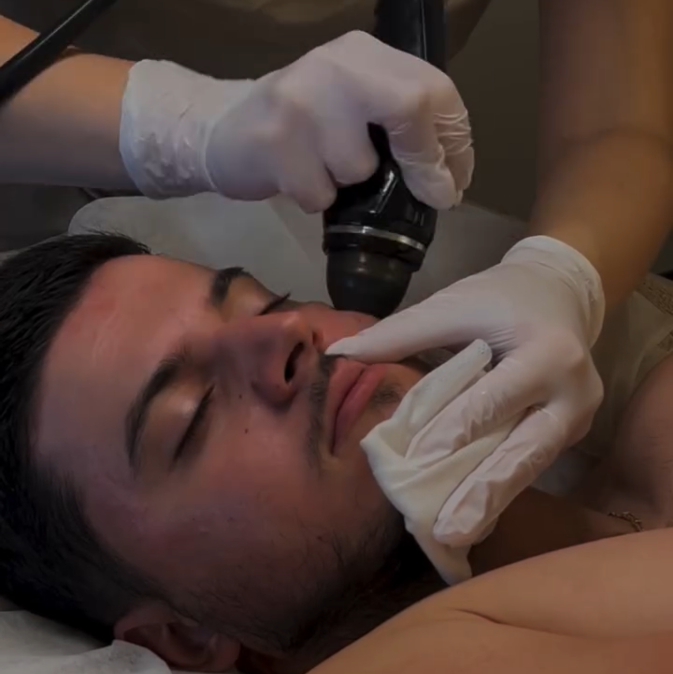 A close-up of a man lying down during a facial treatment, with a practitioner wearing white gloves holding a handheld device against his face.