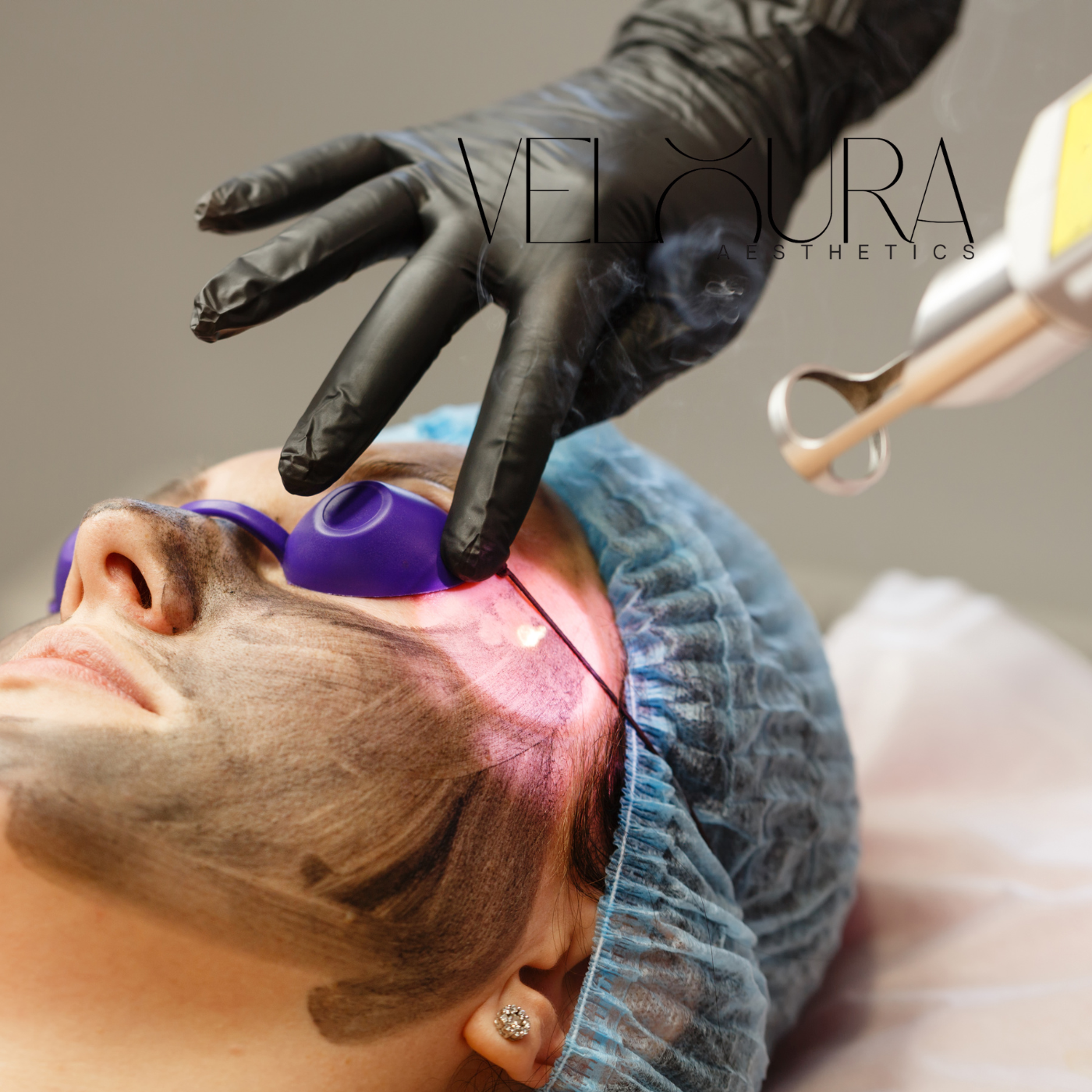 Person receiving a facial treatment with a gloved hand applying a device, branded 'Veloura Aesthetics'.